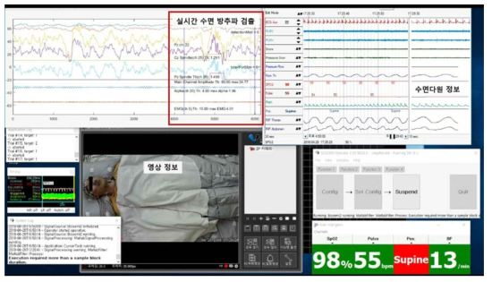 실시간 수면 조절 Closed-loop 시스템