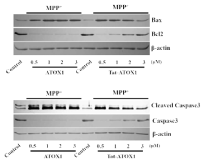 세포사멸 표지자인 Caspase3, Bax 그리고 Bcl2에 대한 Tat-ATOX1의 보호효능