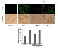 Tat-Atox1 융합단백질의 보호 효과