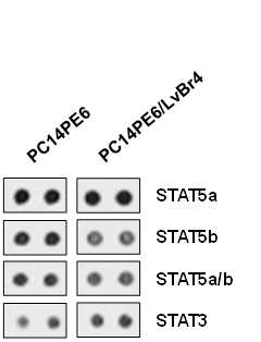 원발암(PC14PE6)와 뇌전이암(PC14PE6/LvBr4)의 STAT 경로 활성화 비교