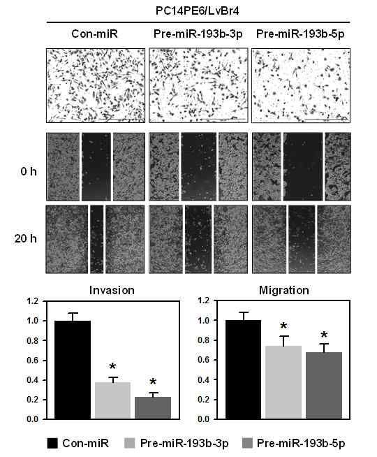 뇌전이암(PC14PE6/LvBr4)에서 miR-193b에 의한 전이능 억제 효과