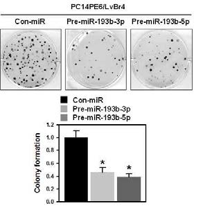 뇌전이암(PC14PE6/LvBr4)에서 miR-193b에 의한 성장 억제 효과