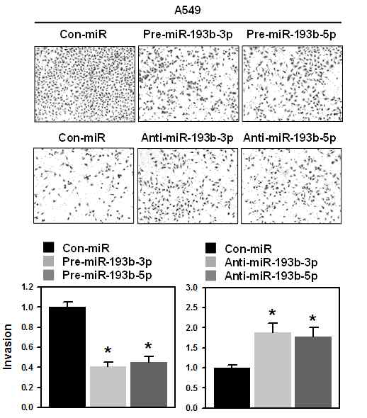 페암(A54904)에서 miR-193b에 의한 침윤성 억제 효과
