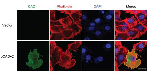 Caldesmon 과발현(overexpression) 후, 고위험 방광암 세포의 morphology 변화