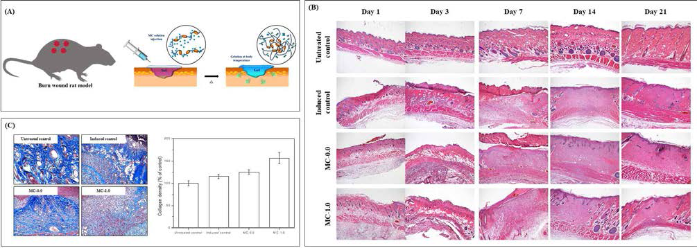 나노입자가 도입된 MC 수화젤을 이용한 화상치료 효과; (A) 전체 실험 모식도, (B) H&E staning, (C) collagen deposition