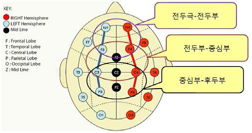 신경학적 예후 예측에 적절한 뇌파 감시 위치 및 기준 분석을 위해 사용된 6개의 뇌파 채널