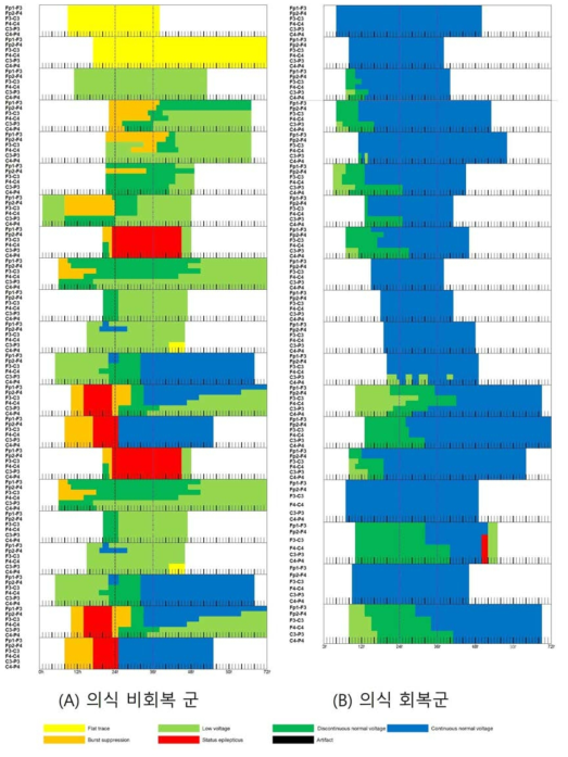 의식 비회복군과 회복군의 순환회복 이후 72시간 동안 뇌파의 기록 및 변화 과정
