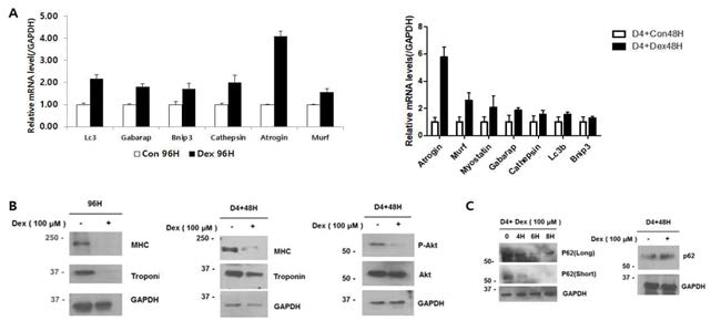 A. In vitro 근위축증 모델에서 Autophagy와 UPS (Ubiquitin proeasome system) 관련 유전자 mRNA level 확인. B. In vitro 근위축증 모델에서 근육단백질 Level 확인. C. Autophagy 관련 단백질 Level 확인