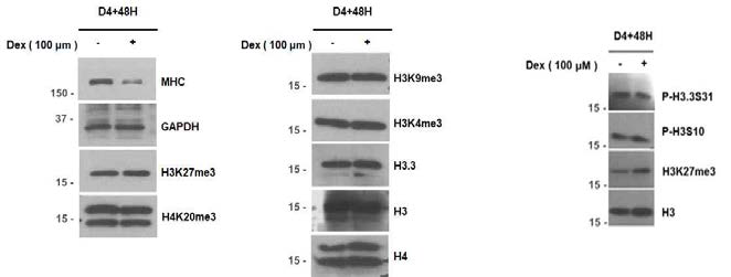 In vitro 근위축증 모델에서 Histone modification 양상변화 Screening