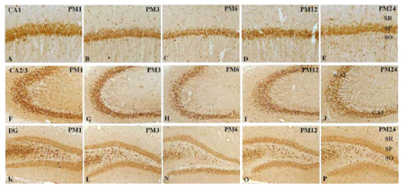 PGRN immunoreactivity in the hippocampal cornus amon (CA)1(A-E), CA2-3(F-J), PM, Postnatal month dentate gyrus (DG, K-P), PM, GCL, granule cell layre; PL, polymorphic layer; SO, Stratum oriens; SP, stratum pyramidale; SR, stratum radiale