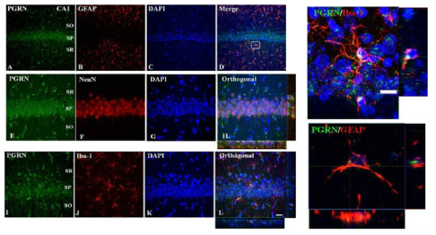 Double immunofluorescent for PGRN/NeuN, PGRN/GFAP and PGRN/Iba-1(Left panel) and itshHigh magnification photos(right panels). Note that PGRN expression in the cytosol of neurons and microglia