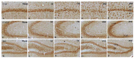 Post ischemic change of PGRN expression in the CA1(A-E), CA2/3(F-J) and DG(K-P) of the hippocampus. Note that significant loss of PGRN expression in the stratum pyramidale of the hippocampal CA1 region (C)