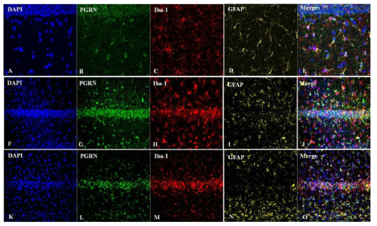 Triple-immunohistofluorecence of PGRN/, Iba-1/GFAP with DAPI for nucleus in the hippocampal CA1 after ischemia