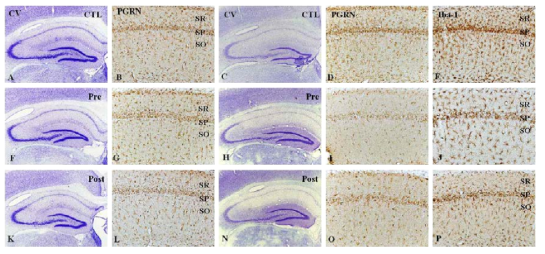 Cresyl violet staining(A, F, K, C, H and N), PGRN and Iba-1 immunostaining in pre and post treatments of PGRN enhancer and chelating agent in ischemic models