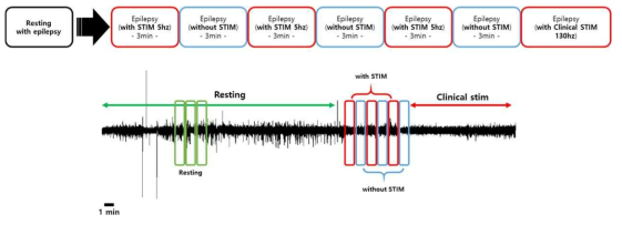 EEG 신호의 구성 형태