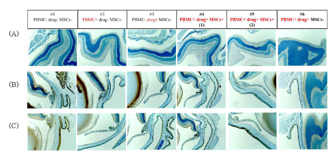 (A) cleaved caspase 3 염색 (B) Fas ligand 염색 (C) Interferon gamma 염색