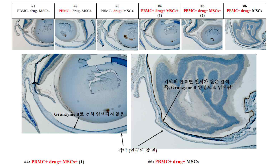 Granzyme B 염색