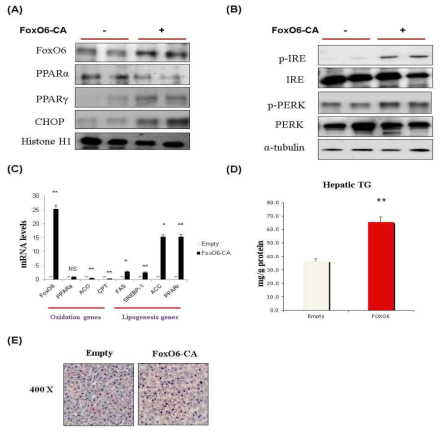 FoxO6 과발현 마우스의 간에서 er stress 유도와 지방대사