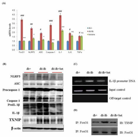 당뇨모델에서 FoxO1으로 인한 inflammasome 형성과 베타인의 효과