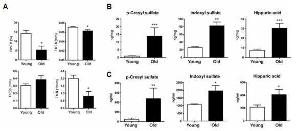 (A) 노화에 의한 골소실 (B) 노화 생쥐의 뼈조직에서의 uremic toxin 대사산물의 증가 (C) 노화 생쥐의 혈액에서의 uremic toxin 대사산물의 증가