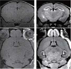 (좌) MRI로 촬영한 뇌사진 (우) 조영제를 사용하여 MRI로 촬영한 뇌사진