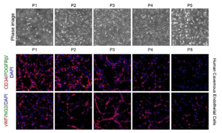 Decrease in the expression of endotherial cell markers. Immunofluorescent staining with antibodies against CD34, vWF, NG2, and PDGFRb (lower panel). CD34 or vWF (red) was endothelial cell marker. PDGFRb or NG2 (green) was pericyte marker