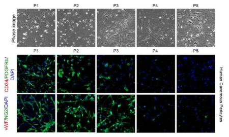 Decrease in the expression of pericyte marker. Immunofluorescent staining with antibodies against CD34, vWF, NG2, and PDGFRb (lower panel). CD34 or vWF (red) was endothelial cell marker. PDGFRb or NG2 (green) was pericyte marker