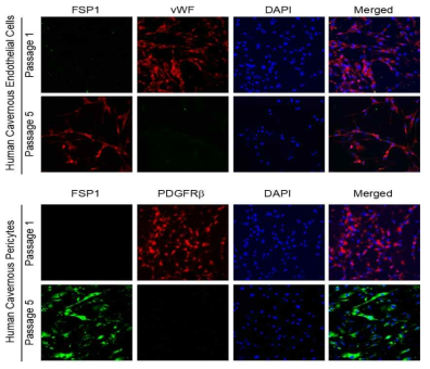 The exchange of cell property. Immunofluorescent staining with antibodies against FSP1, vWF, and PDGFRb. The endothelial marker (vWF; red) or pericyte marker (PDGFRb; red) was expressed on passage 1. FSP1 (red or green),fibroblast marker was expressed on passage 5