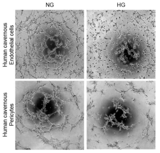 The capacity of tube formation. Primary human endothelial cells or pericytes were exposed to normal glucose condition (NG, 5 mmol) and high-glucose condition (HG, 30 mmol) for 48 hours. Screen magnification = x40