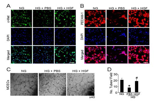 HGF protein transfer enhances tube formation in primary cultured MCECs exposed to high-glucose condition