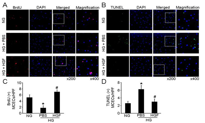 HGF protein transfer induces proliferation and decreases apoptosis in primary cultured MCECs exposed to high-glucose condition