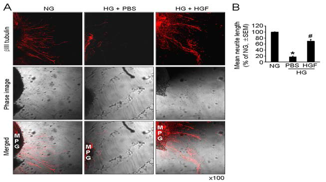 HGF protein transfer induces neurite outgrowth in primary cultured mouse MPG tissue exposed to high-glucose condition. HGF,hepatocyte growth factor; MPG, major pelvic ganglion