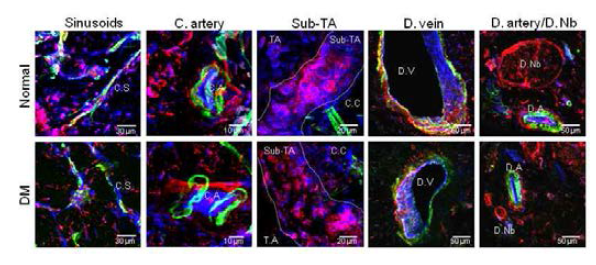 Decrease in the expression of markers for endothelial cells, smooth muscle cells, and pericytes in the penis of diabetic mice. Merged images of transverse thick-cut (50 μm) sections depicted by CD31 (an endothelial cell marker, blue), smooth muscle α -actin (a smooth muscle cell marker, green), and NG2 (a pericyte marker, red) staining. Subtunical area was defined with white dotted demarcation. Diabetes was induced in 8-week-old C57BL/6J mice by intraperitoneal injections of streptozotocin (50 mg/kg) for 5 days consecutively. Eight weeks after diabetes was induced, the penis was harvested for histologic examination. Sixteen-week-old normal mice were served as a control. Thickness of each stack is 35 μm and 36 images were used for three-dimensional reconstruction. C.A = cavernous artery; C.C = corpus cavernosum; C.S = cavernous sinusoids; D.A = dorsal artery; DM = diabetes mellitus; D.Nb = dorsal nerve bundle; D.V = dorsal vein; T.A = tunica albuginea; Sub-TA = subtunical area