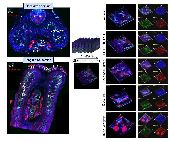 The principle of three-dimensional reconstruction of penile neurovascular system. Reconstruction of a three-dimensional image from stacks of two-dimensional images allows volume rendering and is useful for visualizing internal structures. CD31, an endothelial cell marker, blue; smooth muscle α-actin (SMA), a smooth muscle cell marker, green; βIII-tubulin, a neuronal marker. C.A = cavernous artery; D.A = dorsal artery; D.Nb = dorsal nerve bundle; D.V = dorsal vein