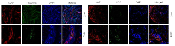 Localization of pericytes in the penis of congenital penile curvature patients with normal erectile function. Immunofluorescent double staining of penile tissue performed with antibodies against CD34 or vWF (endothelial cell marker, red) and PDGFRβ or NG2 (pericyte marker, green). DAPI = 4,6-diamidino-2-phenylindole (a nuclei marker, blue). Images are representative of four independent samples