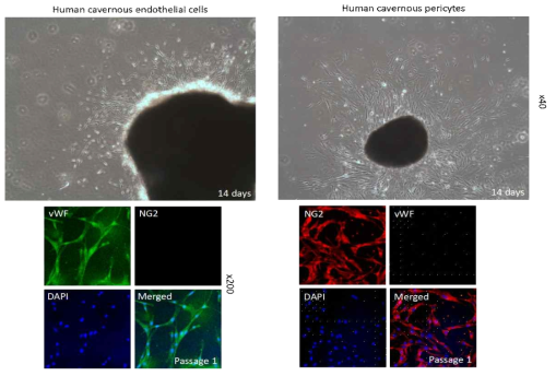 Characterization of Human cavernous endothelial cells and Human cavernous pericytes. Immunofluorescent staining with vWF (endothelial cell marker, green) and PDGFRβ or NG2 (pericyte marker, red). DAPI = 4,6-diamidino-2-phenylindole (a nuclei marker, blue).. The results were similar from more than ten-independent experiments