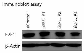 EPEL knockdown 후 E2F1 단백질 발현 패턴