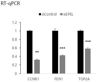 RT-qPCR을 이용한 EPEL knockdown에 의한 CCNB1, FEN1, TOP2A 유전자의 발현량 변화 검증