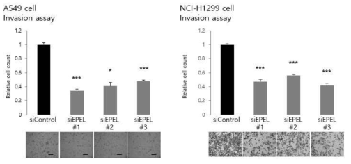 invasion assay 결과 (EPEL knockdown)
