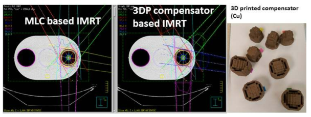 MLC 기반 및 3DP 세기변조체 기반 IMRT 치료계획과 3DP(Cu, FDM이용)로 제작한 세기 변조체