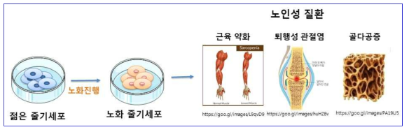 줄기세포의 노화 진행과 관련 노인성 질환