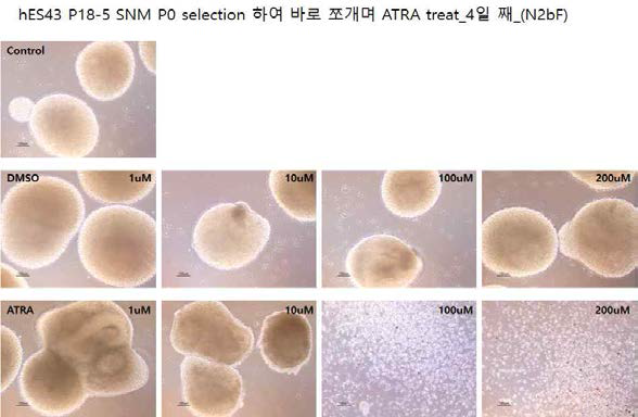 hES43. early SNM(P0) 상태에서 all-trans retinoic acid(ATRA) 처리