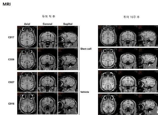 SPIO labeled 도파민 세포를 파킨슨증후군 원숭이에 주입 후 MRI 촬영
