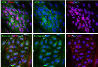 인간배아줄기세포 유래 망막색소상피세포 분화법을 통해 제조한 망막색소상피세포의 확인