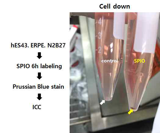 기존 연구에서와 같은 방법으로 SPIO labeling 후 세포원심분리 결과. SPIO염색 후 육안으로 SPIO labeling이 된 것을 확인 가능 함 (yellow 화살표)
