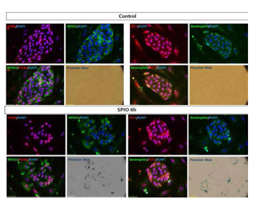 SPIO labeling 후에도 망막색소상 세포의 성질이 변하지않음을 면역 형광염색법으로 확인 Control (위), SPIO labeled (아래)