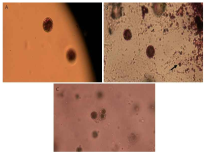 Haematococcus (Red cyst, live) encapsulated by alginate bead. (A)스트론튬 처리 1시간 후 염색 결과 (B) 24시간 후 (C) 48시간 후(400X)