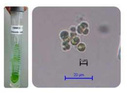 Chlorella vulgaris 무균배양모습과 현미경 관찰 모습 (X400)
