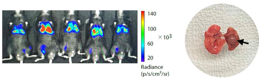 본 연구진이 확립한 마우스 폐암 정위이식 모델