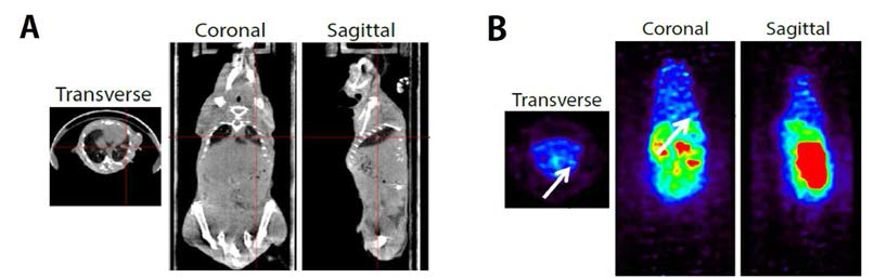 정위이식 폐암의 CT(Computed tomography) 이미지(위)와 F-MISO 흡수를 보여주는 PET 이미지(아래)